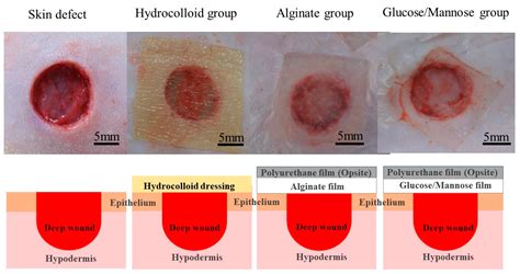 Wound Healing Performance in a Moist Environment of Crystalline Glucose ...