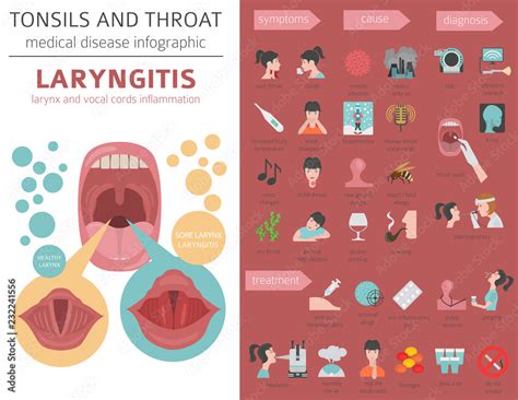 Tonsils Throat Diseases Laryngitis Symptoms Treatment Icon, 52% OFF