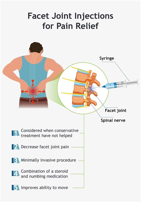 Facet Joint Injections | Advanced Spine and Pain
