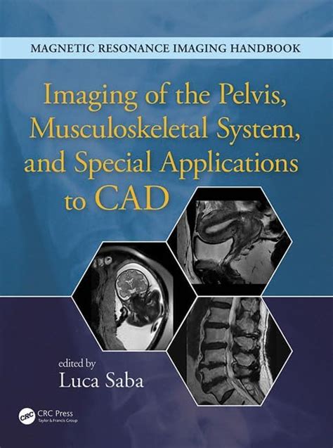 Buy IMAGING OF THE PELVIS MUSCULOSKELETAL SYSTEM AND SPECIAL ...