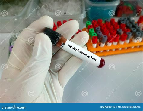 Hepatitis B Surface Antigen HBsAg Test Strip Is A Rapid, Qualitative ...