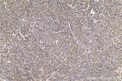 IHCeasy EIF3C Ready-To-Use IHC Kit KHC0168 | Proteintech