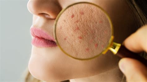 Skin Tips for Glowing Skin: Your Daily Guide