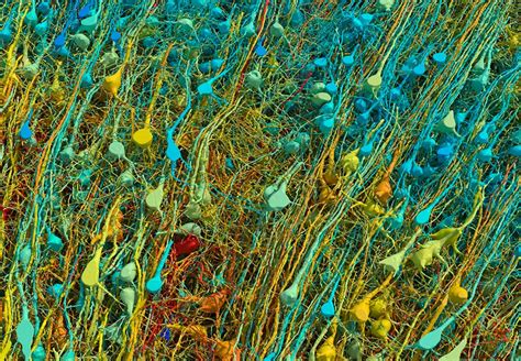 Image result for Brain Tissue Sample