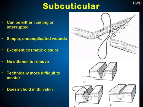 Image result for Suturing Tutorial