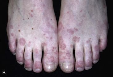 Image result for Rash Algorithm