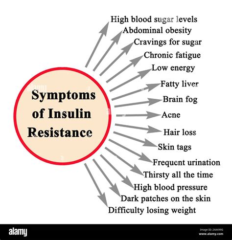 Fifteen Symptoms of Insulin Resistance Stock Photo - Alamy