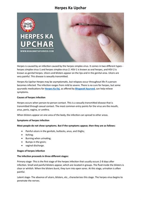 Herpes Ka Upchar.pdf