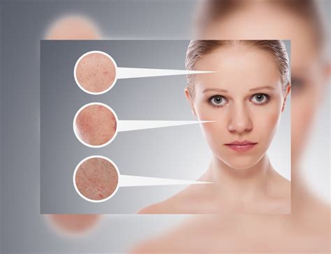 Uneven Skin Tone: Tips To Manage It Naturally - Skin Care Top News