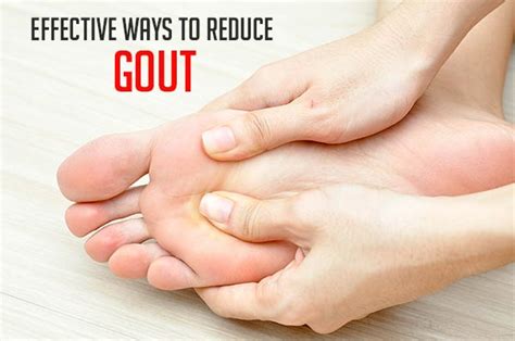 Treatment for Gout in Foot Krutch Details