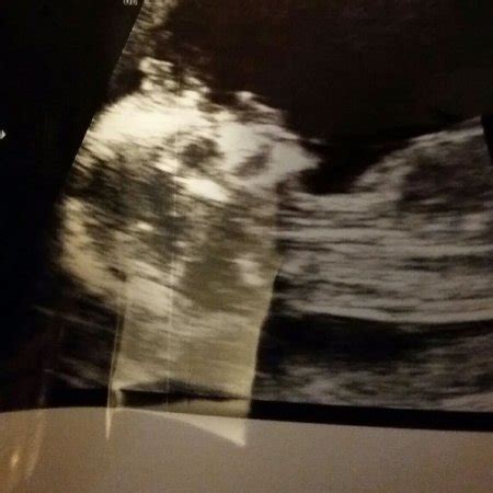 Image result for Alien Ultrasound