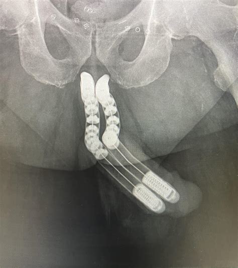 Can anyone explain this? : r/Radiology