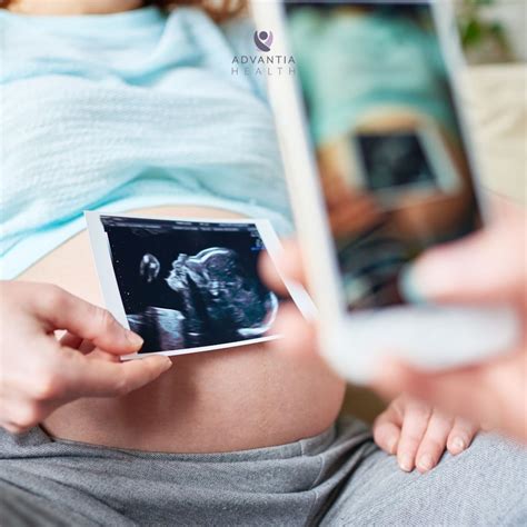 Understanding the 20-Week Anatomy Scan | Advantia Health