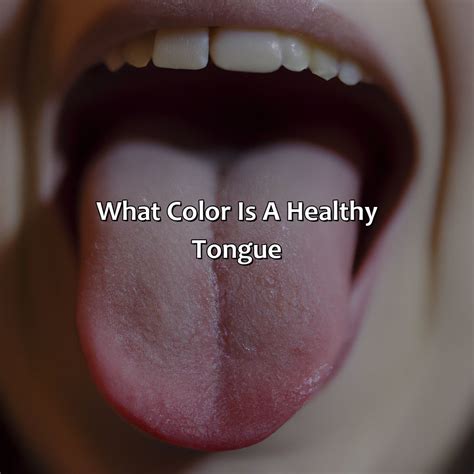 What Color Is A Healthy Tongue - colorscombo.com
