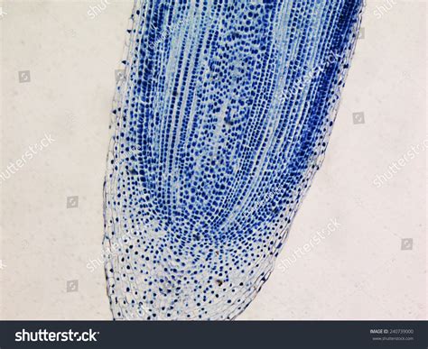 Mitosis Onion Root Tip