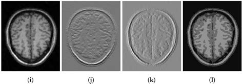On a Variational and Convex Model of the Blake–Zisserman Type for ...