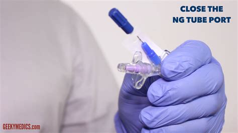 Nasogastric (NG) Tube Insertion - OSCE Guide | Geeky Medics