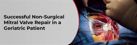 Successful Non-Surgical Mitral Valve Repair in a Geriatric Patient