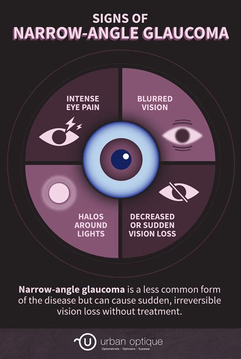 What Is Narrow-Angle Glaucoma? | Urban Optique