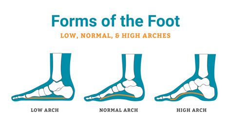 Plantar Fasciitis: Steps To Avoid A Painful Tug Of War In, 59% OFF