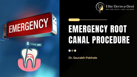 Emergency Root Canal Procedures (2025) - Elite Dermadent