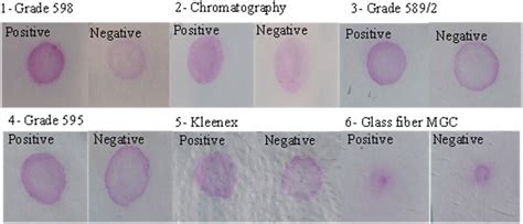 Image result for Agglutination Test