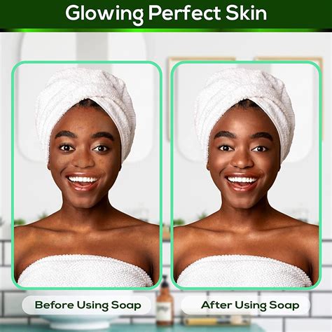 Ahuike African Black Soap 16oz - Organic Acne & Dark Spot Remover for Dry Skin - Face & Body ...