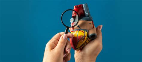 Renal Artery Stenosis | Ailments - MGMCH, Jaipur