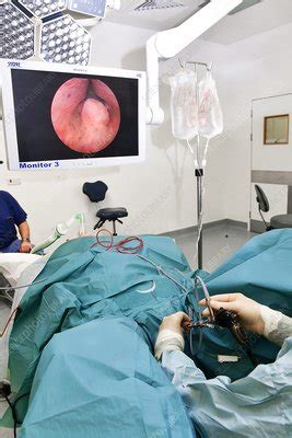 Actual Prostate Surgery 的图像结果