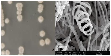 Antagonism of Rhizosphere Streptomyces yangpuensis CM253 against the ...