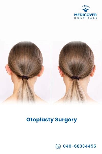 Otoplastia (cirugía de orejas): procedimiento quirúrgico, beneficios y ...