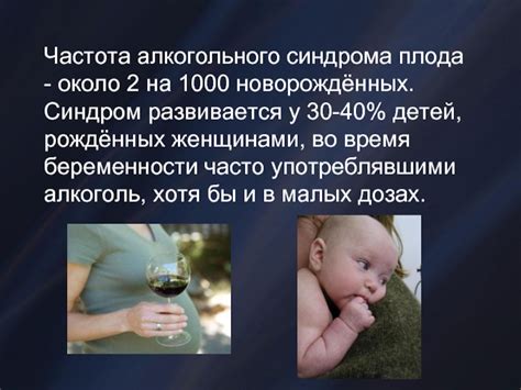 Фетальный алкогольный синдром