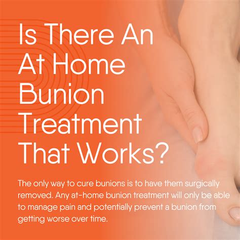 At Home Bunion Treatment - Does It Work? | The Bunion Cure