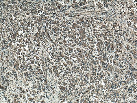 mTOR antibody (28273-1-AP) | Proteintech