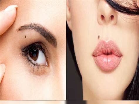 lucky moles on 6 part of of body Male Female Live Whol Life Like King ...