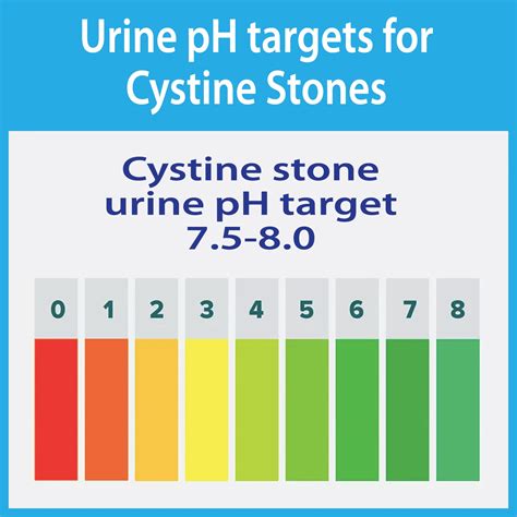 Cystine stones – NoLith