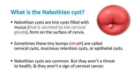 Are Nabothian Cysts Sexually Transmitted