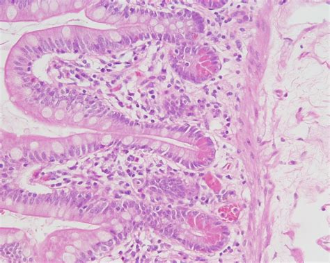 Image result for Small Intestine Epithelial Cells