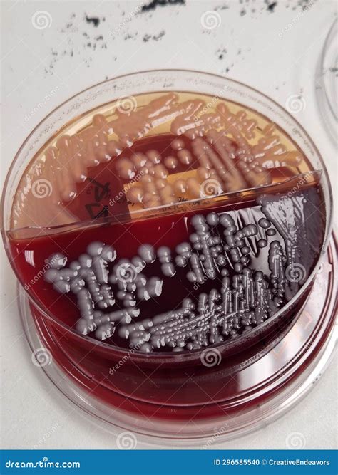 Klebsiella Pneumoniae Bacteria Growing on Blood and Macconkey Agar Stock Photo - Image of ...