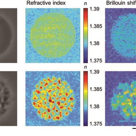 Image result for Phase Contrast Diffraction
