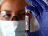 Coronavirus in India: Coronavirus India Latest News, Coronavirus death ...