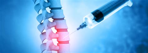 Image result for Fluoro Spinal Injection