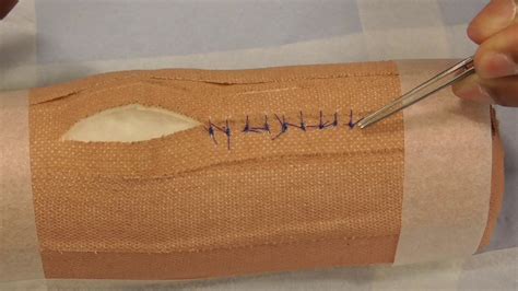 Image result for Simple Continuous Suture Removal