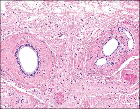 Diseases of the Gallbladder - Clinical Tree