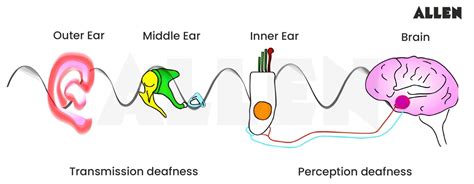 Auditory Pathway: Structure, Functional Significance and FAQs