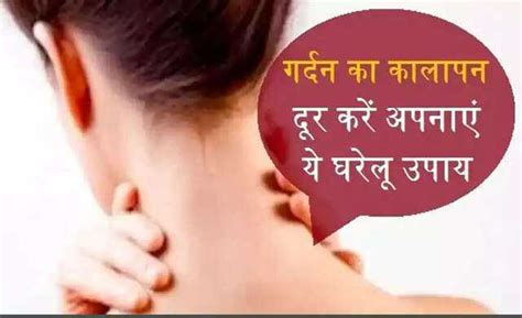 Effective natural remedies for dark neck skin