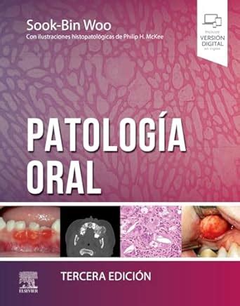 Buy Patología oral Book Online at Low Prices in India | Patología oral ...