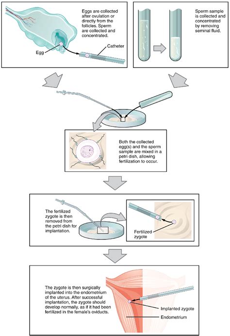 Image result for In Vitro Reproduction