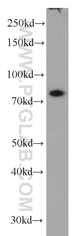 TBX3 antibody (16741-1-AP) | Proteintech