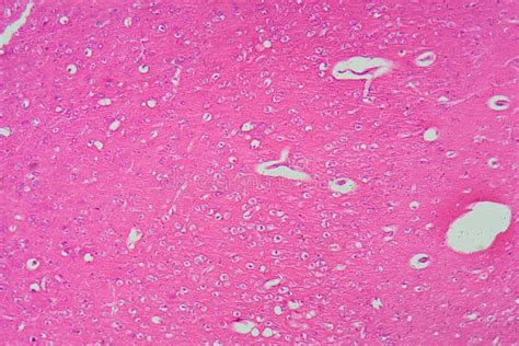 Image result for Brain Under Microscope